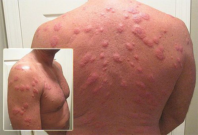чем выводить паразитов из организма человека чем выводить паразитов из организма человека